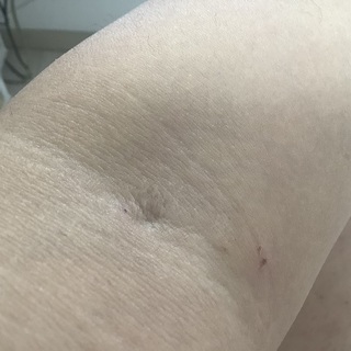 左腕.jpg